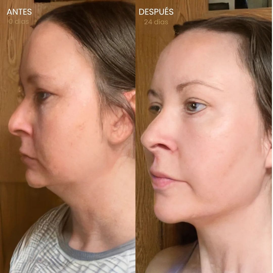 Cepillo linfático facial