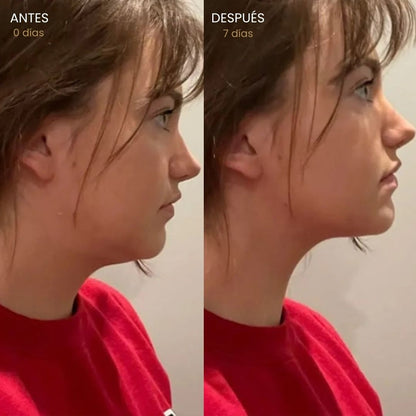 Cepillo linfático facial