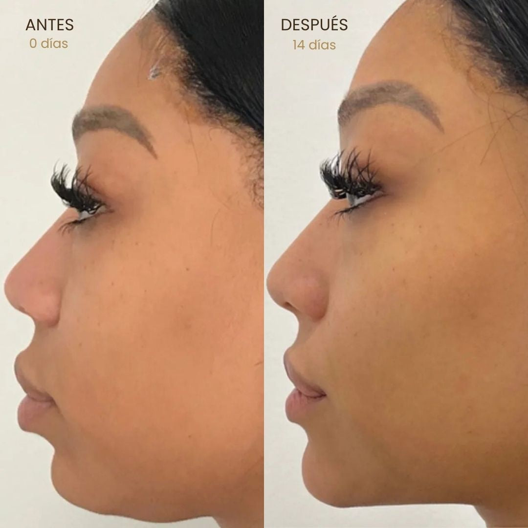 Cepillo linfático facial