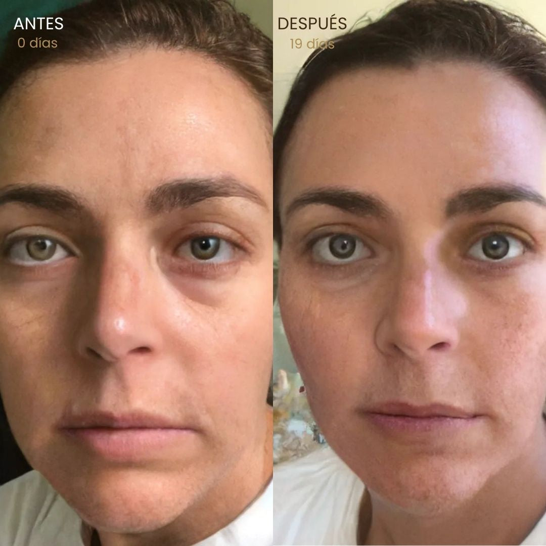 Cepillo linfático facial