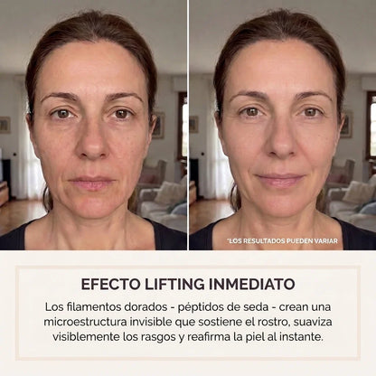 Efecto lifting inmediato