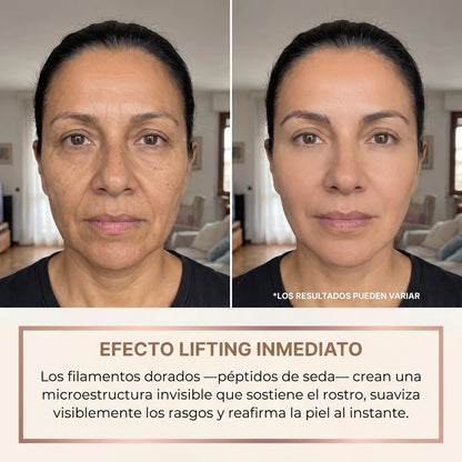 Efecto lifting inmediato antes y después