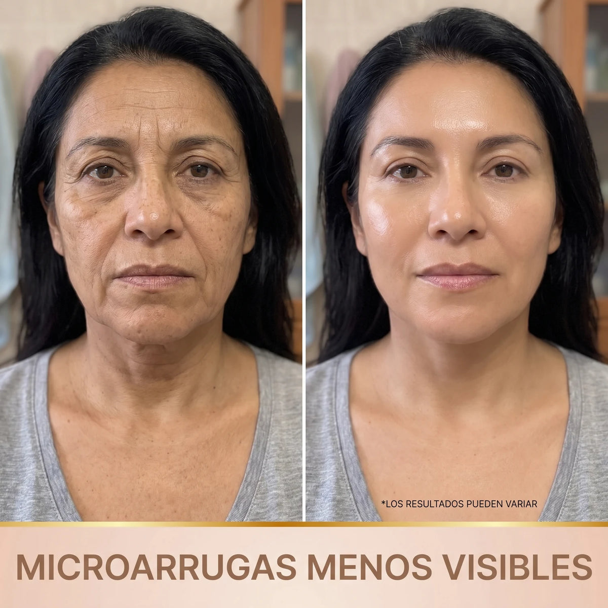 Microarrugas menos visibles