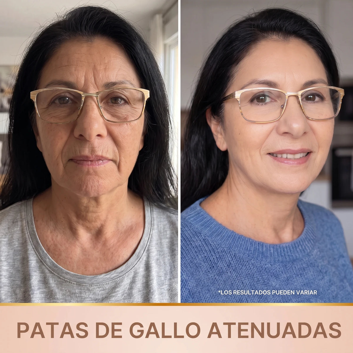 Patas de gallo atenuadas